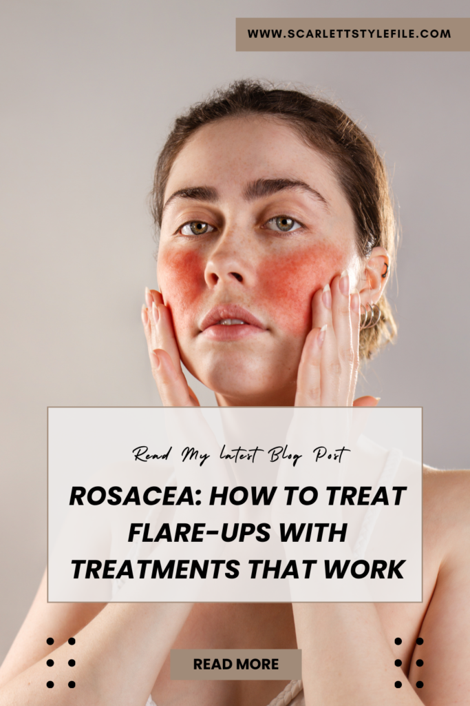 Rosacea: How to Treat Flare-Ups with Treatments That Work