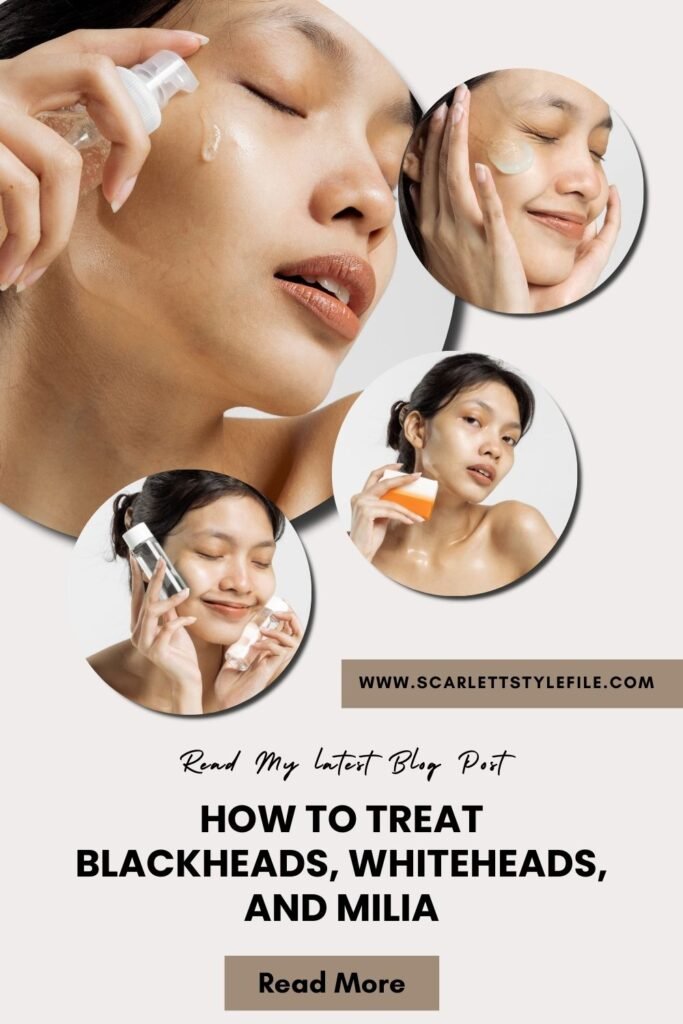 How To Treat Blackheads, Whiteheads, and Milia: Effective Treatments and Prevention