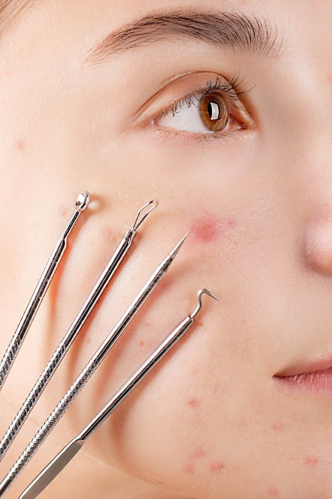 Woman's Face With Four Skin Extractor Tools