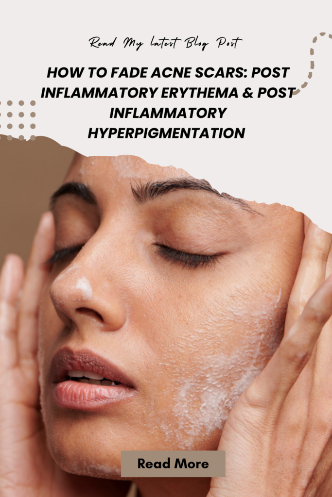 How To Fade Acne Scars: Post Inflammatory Erythema & Post Inflammatory Hyperpigmentation 